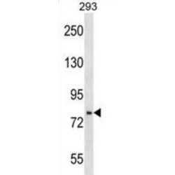 PHD Finger Protein 16 (PHF16) Antibody