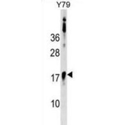 B-Cell CLL/Lymphoma 7B (BCL7B) Antibody
