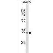 Integral Membrane Protein 2C (ITM2C) Antibody