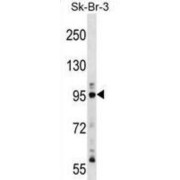 Dual Specificity Protein Kinase TTK (TTK) Antibody