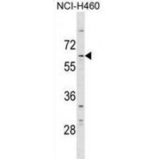 mRNA-Decapping Enzyme 1A (DCP1A) Antibody