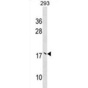 Ubiquitin Conjugating Enzyme E2 V2 (UBE2V2) Antibody