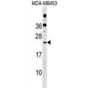 RNA Polymerase II Subunit D (POLR2D) Antibody