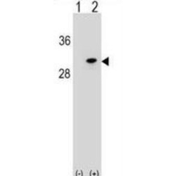 RNA Polymerase II Subunit D (POLR2D) Antibody