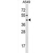 Formyl Peptide Receptor 1 (FPR1) Antibody