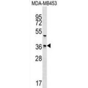 Ubiquitin Conjugating Enzyme E2 Z (UBE2Z) Antibody