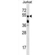 CUGBP Elav-Like Family Member 2 (CUGBP2) Antibody