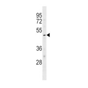 ATP-Sensitive Inward Rectifier Potassium Channel 10 (KCNJ10) Antibody