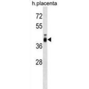 Zona Pellucida Sperm-Binding Protein 3 (ZP3) Antibody