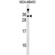 Protein Lin-7 Homolog A (LIN7A) Antibody