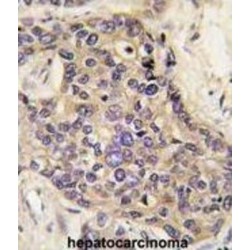 Hepatocyte Growth Factor (HGF) Antibody