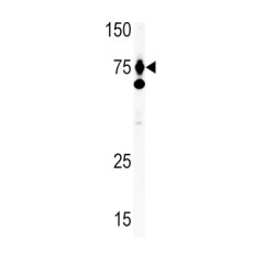 Hepatocyte Growth Factor (HGF) Antibody