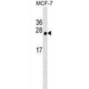 Heme-Binding Protein 1 (HEBP1) Antibody