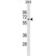 Ring Finger Protein 168 (RNF168) Antibody