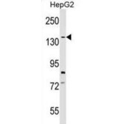 Synaptonemal Complex Protein 1 (SYCP1) Antibody