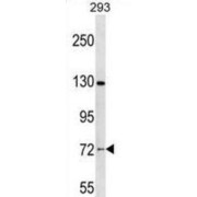 Nucleolar Protein 4 (NOL4) Antibody