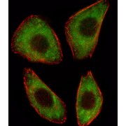 Transcription Factor 25 (TCF25) Antibody