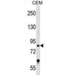 Transcription Factor 25 (TCF25) Antibody