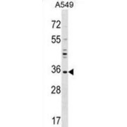 RING Finger Protein Unkempt-Like (UNKL) Antibody