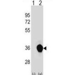 RING Finger Protein Unkempt-Like (UNKL) Antibody