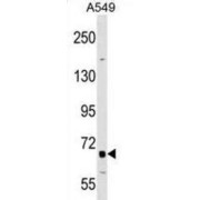 Tumor Necrosis Factor Receptor Superfamily, Member 21 (TNFRSF21) Antibody