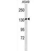 Myosin Binding Protein C, Slow Type (MYBPC1) Antibody