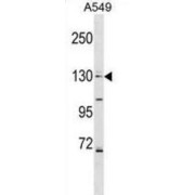 Collagen Type IV Alpha 6 (COL4A6) Antibody