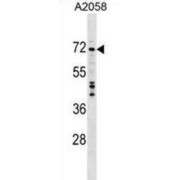 DEAD (Asp-Glu-Ala-Asp) Box Polypeptide 56 (DDX56) Antibody