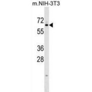 Kelch-Like Protein 12 (KLHL12) Antibody