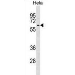 Kelch-Like Protein 12 (KLHL12) Antibody