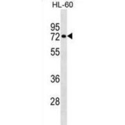 Ras Homolog Family Member T2 (RHOT2) Antibody