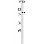 Sorting Nexin 18 (SNX18) Antibody