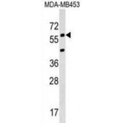 Potassium Voltage-Gated Channel Subfamily S Member 3 (KCNS3) Antibody