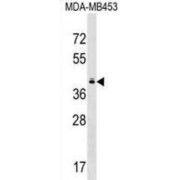 Taste 2 Receptor Member 10 (TAS2R10) Antibody