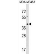 Taste Receptor Type 2 Member 9 (TAS2R9) Antibody