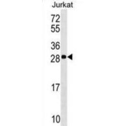 Acidic Leucine-Rich Nuclear Phosphoprotein 32 Family Member C (ANP32C) Antibody