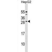 Calcium Binding Protein 4 (CABP4) Antibody