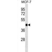 Immediate Early Response Gene 5 Protein (IER5) Antibody