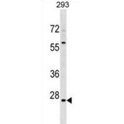 High Mobility Group Nucleosome Binding Domain 5 (HMGN5) Antibody