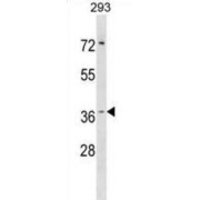 Putative Hydroxypyruvate Isomerase (HYI) Antibody