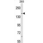 Scaffold Attachment Factor B1 (SAFB) Antibody