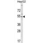 Glioma Tumor Suppressor Candidate Region Gene 2 Protein (GLTSCR2) Antibody