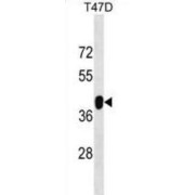 Zinc Finger Protein 322A (ZNF322A) Antibody