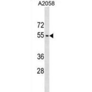 Actin Like 9 (ACTL9) Antibody