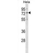 Neuroepithelial Cell Transforming Gene 1 (NET1) Antibody