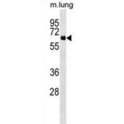 Neuroepithelial Cell Transforming Gene 1 (NET1) Antibody