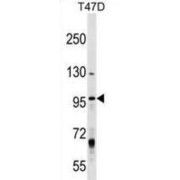 MCM8 Minichromosome Maintenance Deficient 8 (MCM8) Antibody