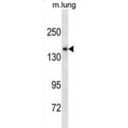 Lysine Demethylase 6B (KDM6B) Antibody