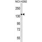 Protein Tyrosine Phosphatase, Non Receptor Type 23 (PTPN23) Antibody