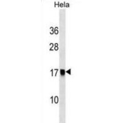 AP-2 Complex Subunit Sigma (AP2S1) Antibody